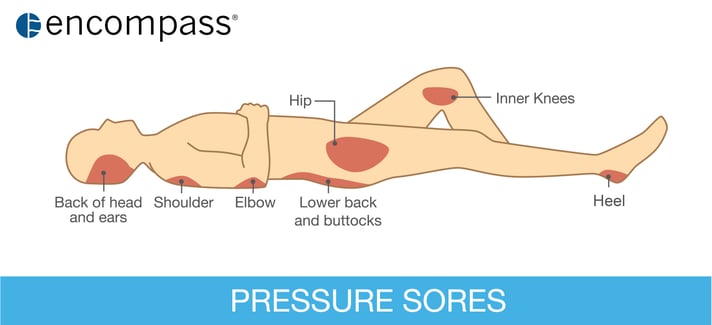 Causes of HAPIs Blog-1